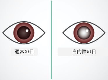 目 の 充血 原因 片目