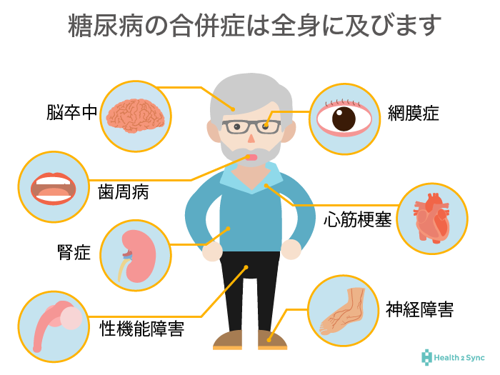 糖尿病の合併症は全身に及ぶ